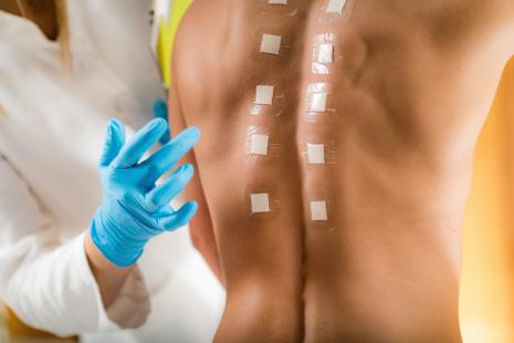 L’enquête allergologique doit être systématique dans l’asthme