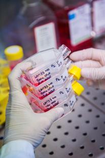 Culture de Cellules Souches Mésenchymateuses (CSM) en milieu liquide.