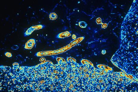 Les résultats montrent une baisse de 75,71 %  des hospitalisations
