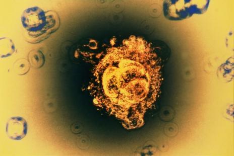 En Israël, des chercheurs ont annoncé avoir développé des structures similaires à l'embryon humain