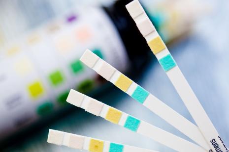 Le boom de l’autodiagnostic inquiète les pharmaciens