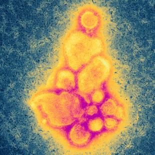 Virus de la grippe aviaire A souche H7N9, apparu en Chine en Mars 2013. Microscopie électronique à transmission (MET).