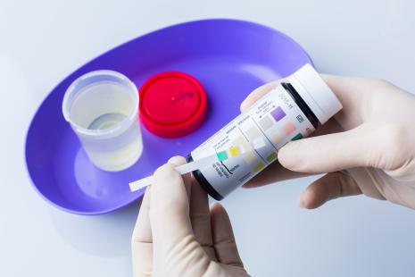 En cas de cystite, la prise en charge concerne les patientes âgées de 16 à 65 ans qui se présentent spontanément à l’officine ou orientées par un médecin ou une sage-femme