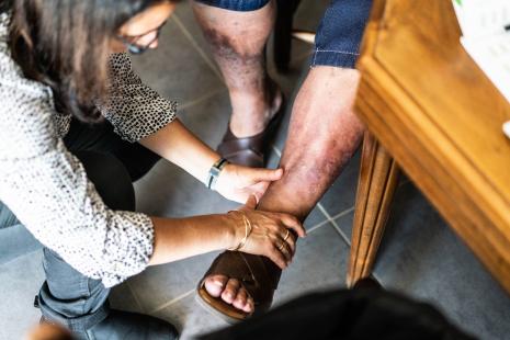 Les ulcères d’origine veineuse touchent environ 600 000 patients