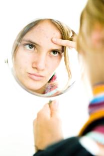 Les premiers conseils dans l’acné sont de respecter la peau et de la protéger