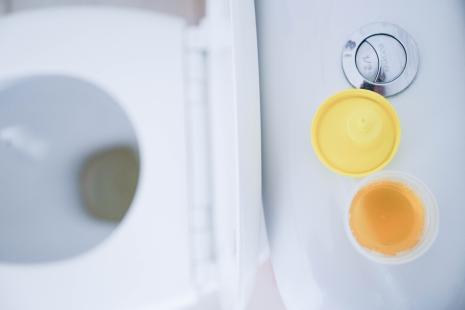 Pour la CNAM, la présence de toilettes à l’officine est obligatoire pour ouvrir droit à une prise en charge