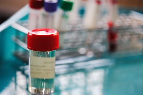 Plusieurs études confirment l’importance des mésusages diagnostiques en infectiologie