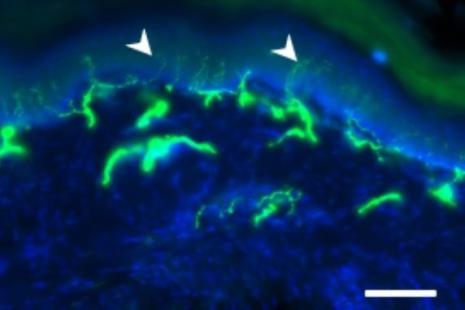 Image au microscope (peau de rat) : les fibres nerveuses (en vert, indiquées par les flèches blanches) restent intactes grâce à Carba1 malgré un traitement par paclitaxel