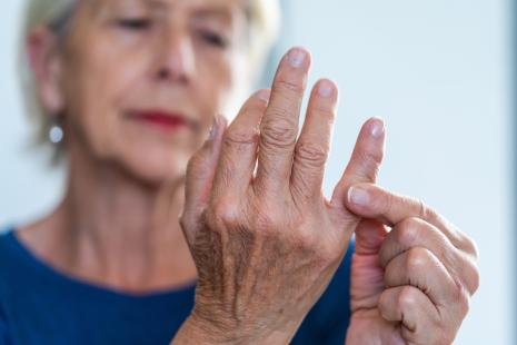 Pour limiter son évolution, l’arthrose digitale nécessite une prise en charge précoce