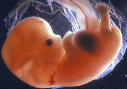foetus