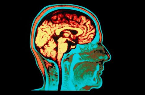 Une interface entre des signaux électriques du cerveau et l’informatique