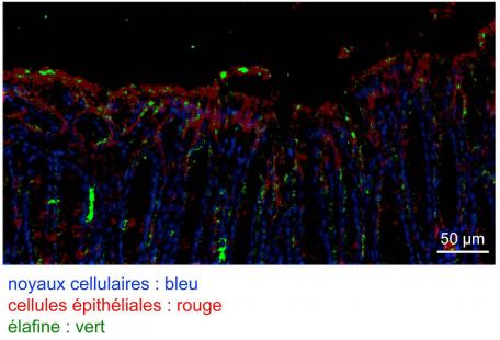Vert : élafine. Rouge : cellules épithéliales. Bleu : noyaux cellulaires
