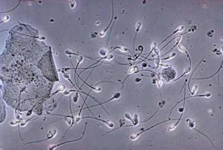 Le nombre et la qualité des spermatozoides ont diminué en seize ans