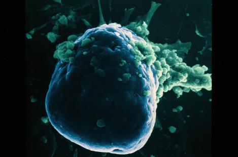 L’administration de l’acide biliaire a amélioré le survie de cellules bêta pancréatiques