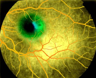 Un schéma d’administration amélioré