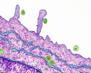Le virus de l'hépatite C n'a été découvert qu'en 1989