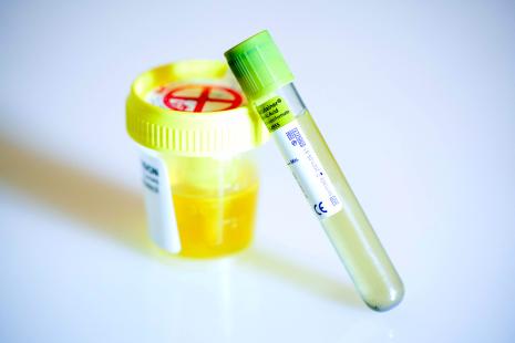 Les médicaments des pathologies urinaires
