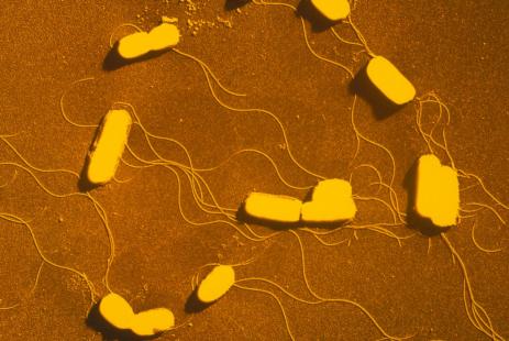 Listeria monocytogenes 