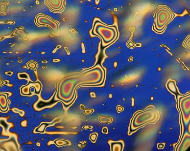 Cristaux de vitamine E (tocophérol). Microscope en lumière polarisée, grossissement 100x.