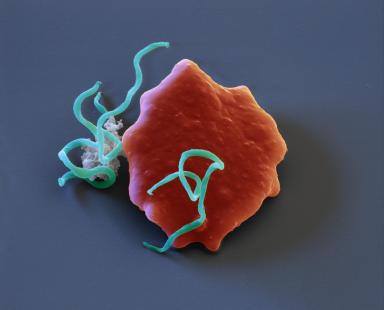Un diagnostic qui peut être complexe