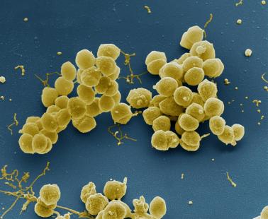 Une souche hautement pathogène et invasive