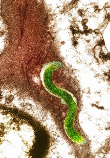 Les infections sexuellement transmissibles