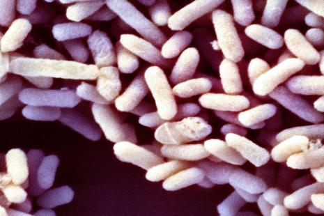 Bifidobacterium breve