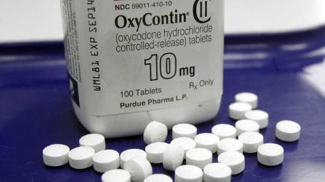 Oxycontin