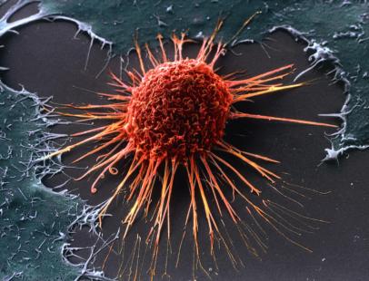Cancer col