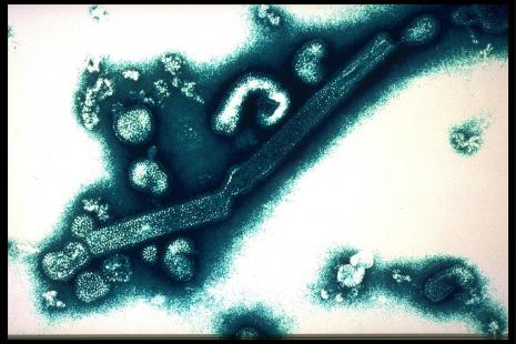 virus de la grippe





virologie