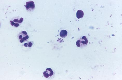 L’hémolyse déclenchée par le Plasmodium aboutit au relargage de l’hème