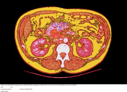 Un dépistage précoce à la clé
