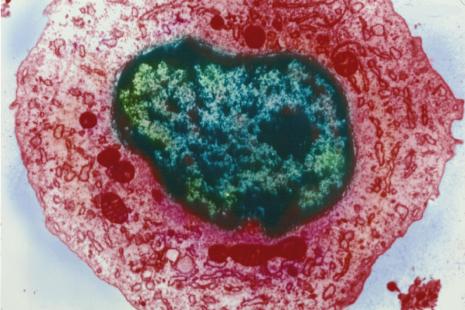 Le " soi » est reconnu comme étranger par le système immunitaire