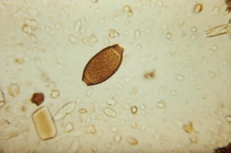 Le patient a ingéré des œufs de Trichuris trichiura 