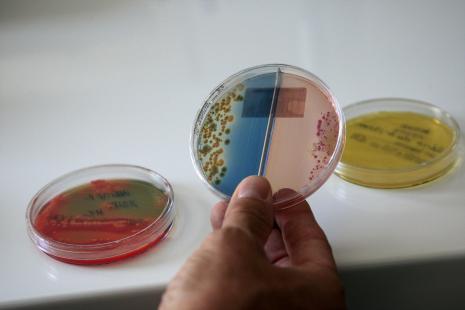 L'hémophilus est de plus en plus résistant aux antibiotiques