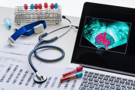 Le cancer prostatique