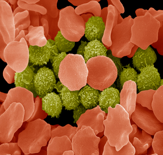 photo art hématologie