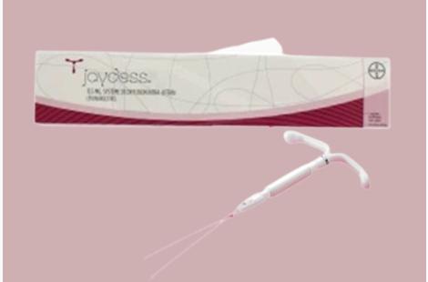 Jaydess et risque de grossesse extra-utérine : arrêt des prescriptions